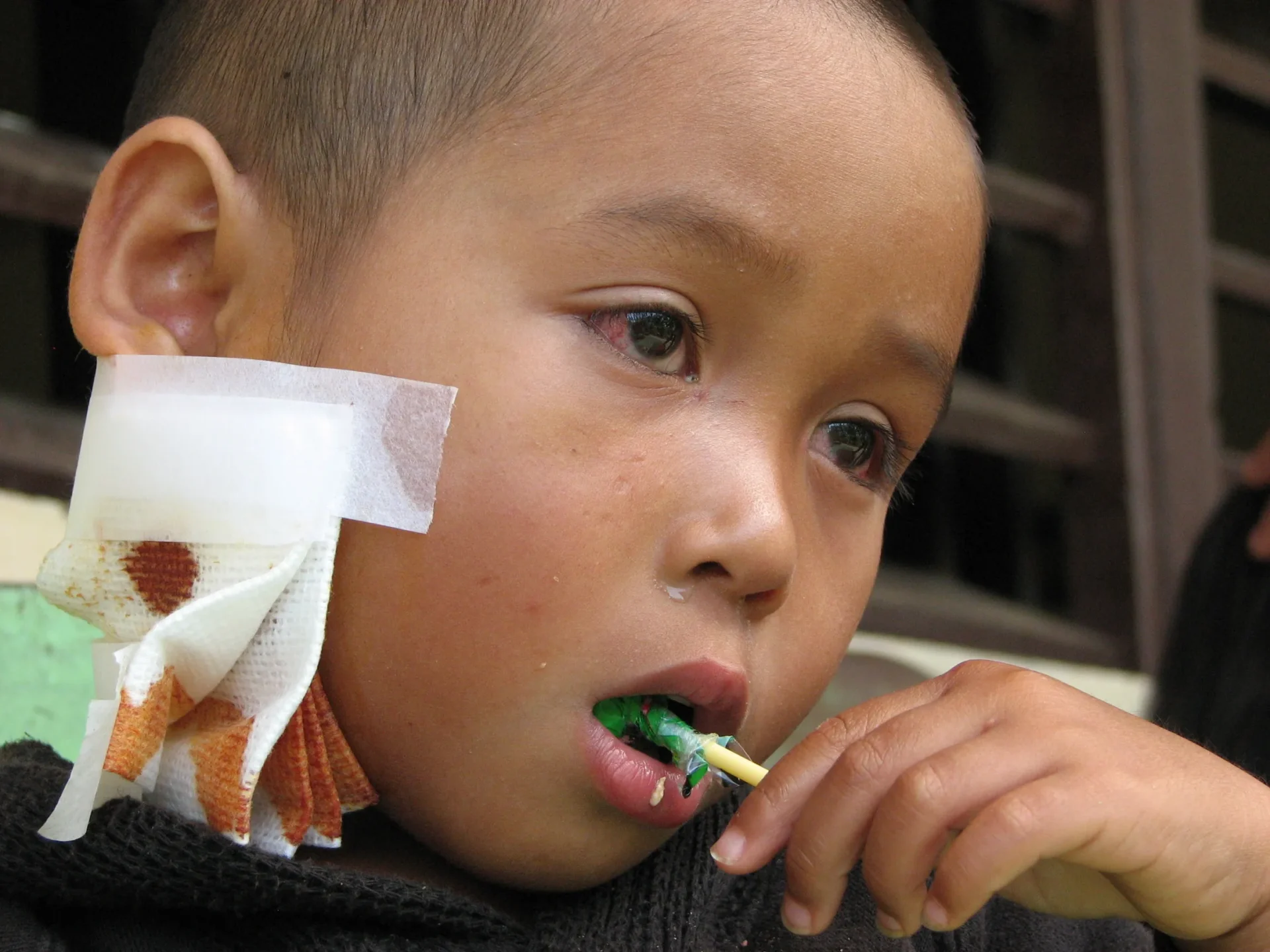 A child with a bandaged ear holds a green whistle in their mouth.