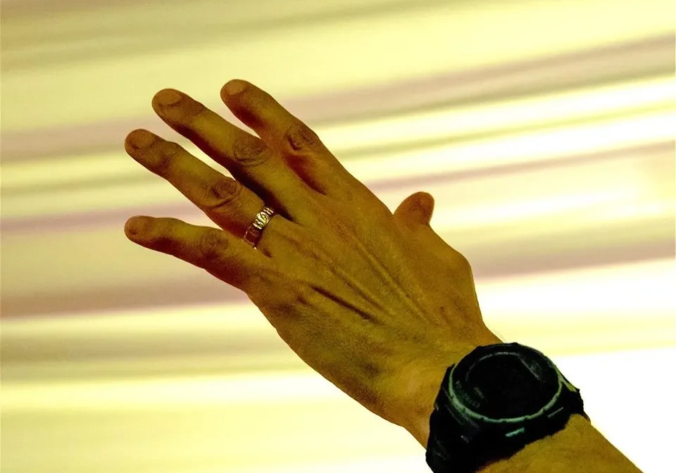 A person's raised hand showing a wristwatch and a ring against a blurred striped background.